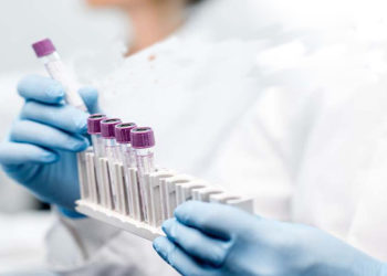 Coronavirus: seus totus in zona arrùbia