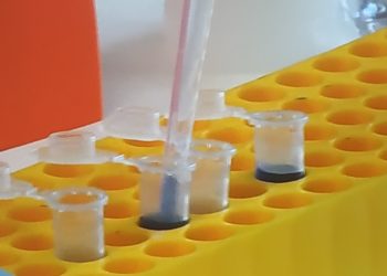 Salgono a 1.113 i casi positivi al Covid-19 in Sardegna, 22 più di ieri (543 i tamponi eseguiti). Invariato il numero di decessi, 73