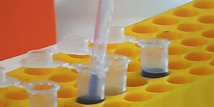 Salgono a 1.113 i casi positivi al Covid-19 in Sardegna, 22 più di ieri (543 i tamponi eseguiti). Invariato il numero di decessi, 73