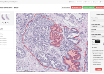Pubblicato su Nature Scientific Reports uno studio sulle valutazioni diagnostiche del tumore prostatico mediante il sistema di microscopia virtuale del CRS4
