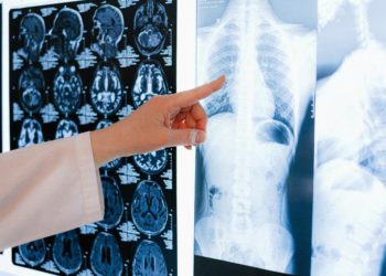 Un progetto “Topp” per i pazienti con tumore polmonare