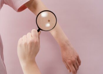 “Open day melanoma” all’Aou di Sassari