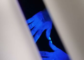 Il lavaggio delle mani contro le infezioni ospedaliere