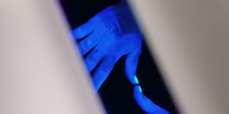 Il lavaggio delle mani contro le infezioni ospedaliere