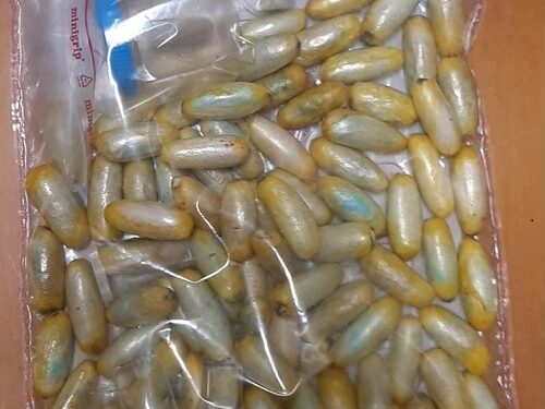 Un 33enne nigeriano è stato trasportato all’ospedale Brotzu colto da malore. Aveva ingerito 90 ovuli di droga, arrestato dalla Polizia di Stato