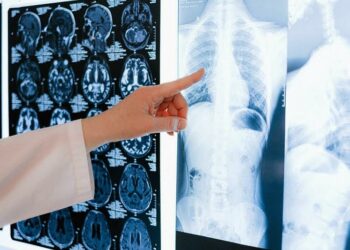 Il 15 novembre a Sassari, oncologi e specialisti si riuniscono per discutere i progressi nella diagnosi e trattamento dei tumori toraco-polmonari