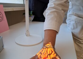 Un rilevatore di vene a infrarossi per i pazienti dell’Oncologia all’AOU di Sassari